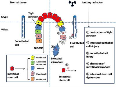 Research progress on the mechanism of <mark class="highlighted">radiation enteritis</mark>